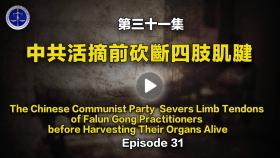第31集 中共活摘法轮功学员器官前砍断他們的四肢肌腱