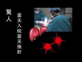 （视频） 惊人！当天入院当天换肝！